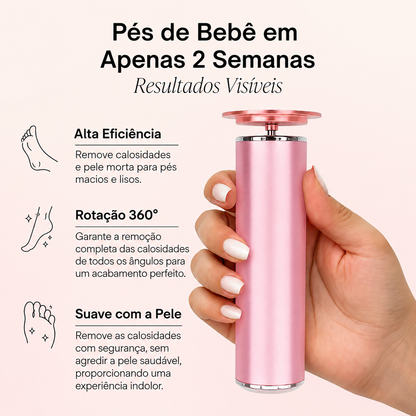 Velura™ Baby Foot – Electric Callus Remover