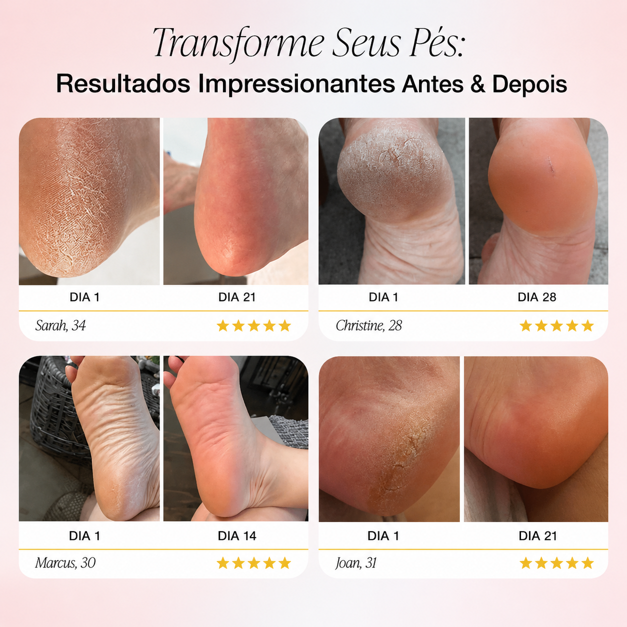 Velura™ Baby Foot – Electric Callus Remover