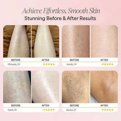 Velura™ Trimmer 2.0 – 2-in-1 Technology for Perfectly Smooth Skin